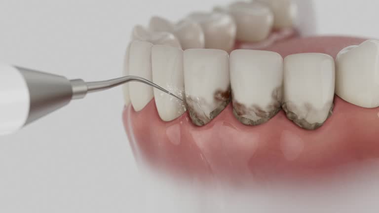 Reliable Dental Implants contractor in Continental, OH by Smile Center Dentistry
